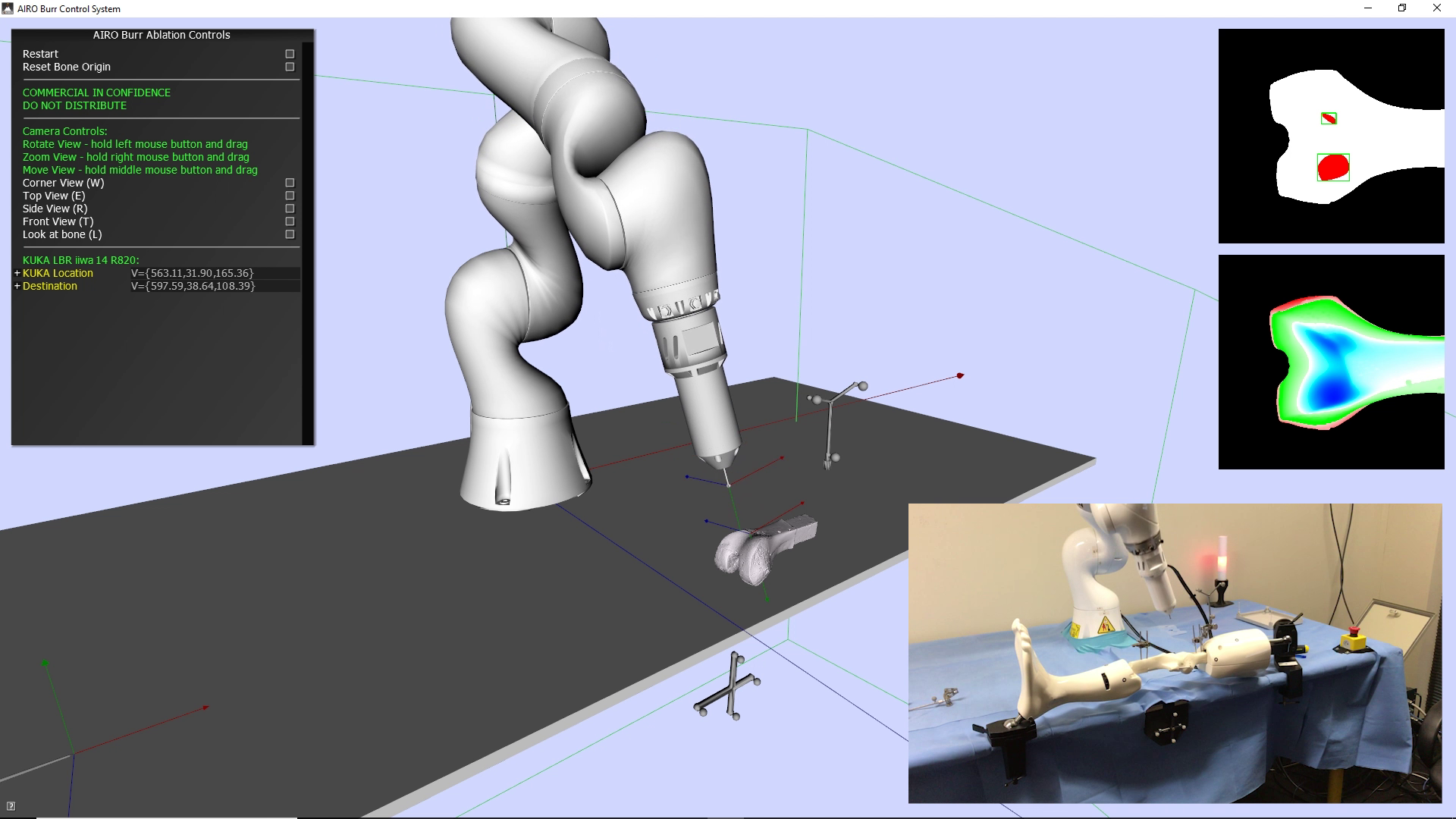 Burr ablation combining footage and screen capture of rendering